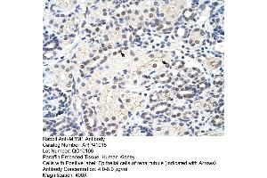 Rabbit Anti-MRM1 Antibody  Paraffin Embedded Tissue: Human Kidney Cellular Data: Epithelial cells of renal tubule Antibody Concentration: 4. (MRM1 antibody  (C-Term))
