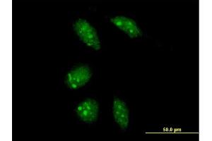 Immunofluorescence of purified MaxPab antibody to GLTSCR2 on HeLa cell. (GLTSCR2 antibody  (AA 1-478))