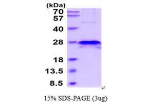 TIMP Metallopeptidase Inhibitor 4 (TIMP4) (AA 30-224) protein (His tag)