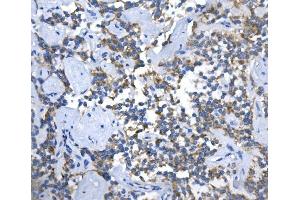 IHC analysis of ASS1 using anti-ASS1 antibody (ABIN7601190).