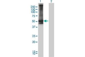 Western Blotting (WB) image for anti-Arrestin, beta 2 (ARRB2) (AA 300-409) antibody (ABIN559954)