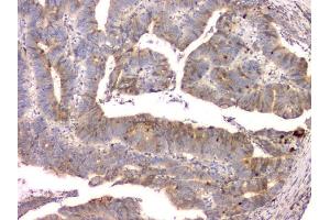 IHC analysis of Cystatin C/CST3 using anti-Cystatin C/CST3 antibody (ABIN6719299). (CST3 antibody  (AA 31-146))