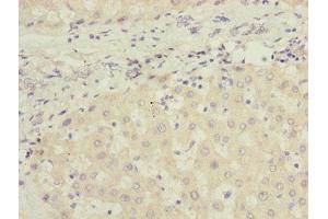 Immunohistochemistry of paraffin-embedded human liver tissue using ABIN7165663 at dilution of 1:100 (PHF17 antibody  (AA 543-842))