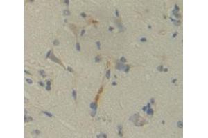 Figure. (OSTF1 antibody  (AA 12-214))
