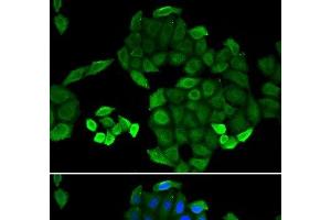 Immunofluorescence analysis of MCF-7 cells using PTS Polyclonal Antibody (PTS antibody)