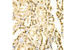 Immunohistochemistry (Paraffin-embedded Sections) (IHC (p)) image for anti-Mitogen-Activated Protein Kinase 3 (MAPK3) (AA 1-100) antibody (ABIN3020725)