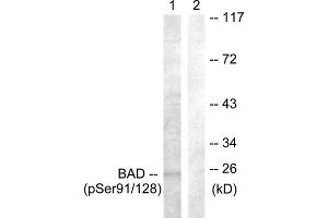Western blot analysis of extracts from COS7 cells, treated with TNF-a (20ng/ml, 30mins), using BAD (Phospho-Ser91/128) antibody. (BAD antibody  (pSer91, pSer128))