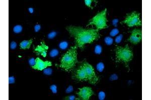 Immunofluorescence (IF) image for anti-Katanin P80 (WD Repeat Containing) Subunit B 1 (KATNB1) antibody (ABIN1498988) (KATNB1 antibody)