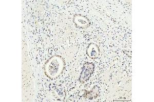 IHC analysis of DDX1 using anti-DDX1 antibody (ABIN7602050). (DDX1 antibody  (AA 562-740))