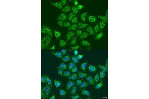 Immunofluorescence analysis of U2OS cells using UBE2A antibody (ABIN6132759, ABIN6149781, ABIN6149783 and ABIN6216187) at dilution of 1:100. (UBE2A antibody  (AA 1-152))