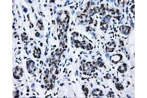 Immunohistochemical staining of paraffin-embedded breast tissue using anti-RALBP1 mouse monoclonal antibody.