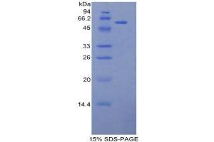 SDS-PAGE (SDS) image for L1 Cell Adhesion Molecule (L1CAM) (AA 882-1132) protein (His tag,GST tag) (ABIN2123132)