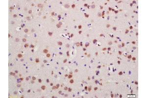 Formalin-fixed and paraffin embedded mouse brain labeled with Rabbit Anti-Glutamine synthetase Polyclonal Antibody, Unconjugated (ABIN754468) at 1:200 followed by conjugation to the secondary antibody and DAB staining (GLN1 antibody  (AA 285-373))