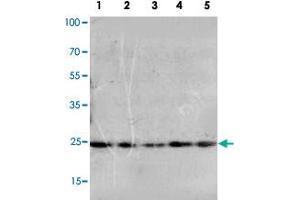 Western blot analysis of whole cell extracts with FGF10 polyclonal antibody . (FGF10 antibody  (N-Term))