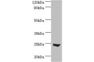 Western blot All lanes: Mitotic spindle assembly checkpoint protein MAD2A antibody at 3 μg/mL + 293T whole cell lysate Secondary Goat polyclonal to rabbit IgG at 1/10000 dilution Predicted band size: 24, 11 kDa Observed band size: 24 kDa (MAD2L1 antibody  (AA 1-205))