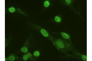 Anti-MAPK6 mouse monoclonal antibody (ABIN2452376) immunofluorescent staining of HeLa cells transiently transfected by pCMV6-ENTRY MAPK6 (RC201597) (MAPK6 antibody  (AA 345-721))