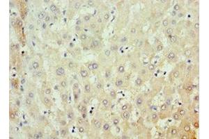 Immunohistochemistry of paraffin-embedded human liver tissue using ABIN7159091 at dilution of 1:100 (MKS1 antibody  (AA 150-300))