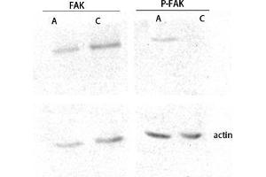 Western Blot (WB) analysis of lysis using FAK antibody. (FAK antibody  (Thr402, Thr421, Thr423))
