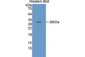 Western blot analysis of the recombinant protein. (NUP62 antibody  (AA 186-432))