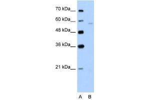 SLC22A7 antibody used at 5 ug/ml to detect target protein. (SLC22A7 antibody)