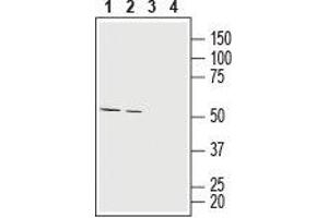 Western Blotting (WB) image for anti-Solute Carrier Family 16, Member 1 (Monocarboxylic Acid Transporter 1) (SLC16A1) (AA 403-415), (Extracellular) antibody (ABIN7043676)