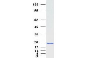 Validation with Western Blot (RAB9A Protein (Myc-DYKDDDDK Tag))