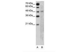 Image no. 1 for anti-Solute Carrier Family 25, Member 46 (SLC25A46) (AA 31-80) antibody (ABIN205025) (SLC25A46 antibody  (AA 31-80))
