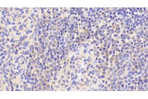 Detection of EFNA3 in Human Spleen Tissue using Polyclonal Antibody to Ephrin A3 (EFNA3) (Ephrin A3 antibody  (AA 30-238))