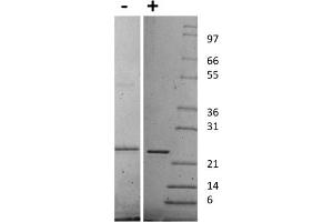 SDS-PAGE (SDS) image for Sonic Hedgehog (SHH) protein (ABIN6700556)