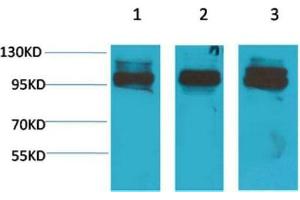 Western Blot (WB) analysis of 1) K562, 2)Mouse Heart Tissue, 3) Rat Heart Tissue with STAT2 Rabbit Polyclonal Antibody diluted at 1:2000. (STAT2 antibody)