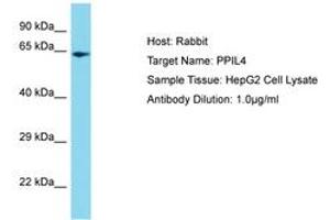 Image no. 1 for anti-Peptidylprolyl Isomerase (Cyclophilin)-Like 4 (PPIL4) (C-Term) antibody (ABIN6750716)
