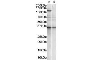 ABIN185369 (1µg/ml) staining of Human Epstein-Barr virus immortilised lymphoblastoid lysate (35µg protein in RIPA buffer) with (B) and without (A) blocking with the immunizing peptide. (PUM2 antibody  (Internal Region))