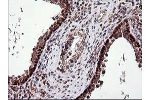 Image no. 1 for anti-Tumor Protein P73 (TP73) (AA 167-409) antibody (ABIN1491006) (Tumor Protein p73 antibody  (AA 167-409))