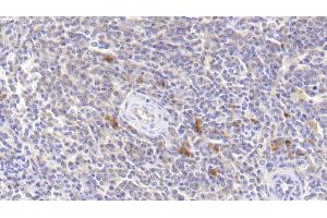 Detection of JAK3 in Human Spleen Tissue using Polyclonal Antibody to Janus Kinase 3 (JAK3) (JAK3 antibody  (AA 716-967))