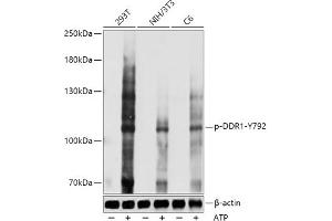 Western blot analysis of extracts of various cell lines, using Phospho-DDR1-Y792 antibody (ABIN7266789) at 1:1000 dilution. (DDR1 antibody  (pTyr792))