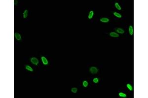 Immunofluorescence (IF) image for anti-Histone Cluster 1, H3a (HIST1H3A) (acLys79) antibody (ABIN7139197)