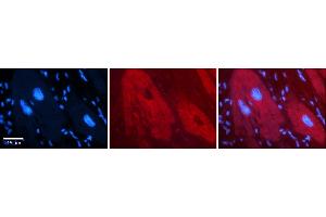 Rabbit Anti-DHX30 Antibody    Formalin Fixed Paraffin Embedded Tissue: Human Adult heart  Observed Staining: Cytoplasmic Primary Antibody Concentration: 1:100 Secondary Antibody: Donkey anti-Rabbit-Cy2/3 Secondary Antibody Concentration: 1:200 Magnification: 20X Exposure Time: 0. (DHX30 antibody  (N-Term))