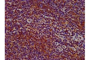 IHC image of ABIN7169553 diluted at 1:400 and staining in paraffin-embedded human lymph node tissue performed on a Leica BondTM system. (Sialoadhesin/CD169 antibody  (AA 572-697))