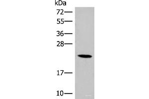 Western blot analysis of 293T cell lysate using DHFR Polyclonal Antibody at dilution of 1:400 (Dihydrofolate Reductase antibody)
