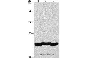 Western blot analysis of A549 cell and mouse liver tissue, hepG2 cell, using PGK1 Polyclonal Antibody at dilution of 1:1000 (PGK1 antibody)