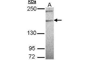 PLCH1 anticorps  (N-Term)