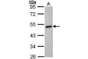 WB Image Sample (30 ug of whole cell lysate) A: Hep G2 , 10% SDS PAGE antibody diluted at 1:1000 (BHMT antibody)