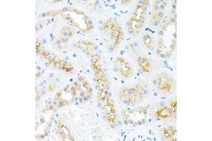 Immunohistochemistry of paraffin-embedded rat kidney using CXCL8 antibody (ABIN6290535) at dilution of 1:100 (40x lens). (IL-8 antibody)