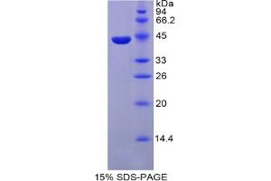 SDS-PAGE analysis of Mouse Parathyroid Hormone Protein. (PTH Protein)