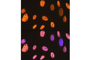 Immunofluorescence (IF) image for anti-Heterogeneous Nuclear Ribonucleoprotein U (Scaffold Attachment Factor A) (HNRNPU) antibody (ABIN1679689)