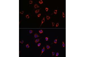 Immunofluorescence (IF) image for anti-Presenilin 1 (PSEN1) (AA 1-160) antibody (ABIN3023160)