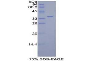 SDS-PAGE analysis of Mouse Dispatched Homolog 1 Protein. (DISP1 Protein)