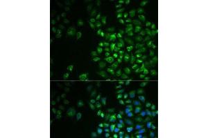 Immunofluorescence analysis of MCF7 cells using POLG2 Polyclonal Antibody (POLG2 antibody)