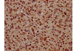IHC image of ABIN7145737 diluted at 1:500 and staining in paraffin-embedded human glioma performed on a Leica BondTM system. (BSX antibody  (AA 1-233))