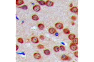 Immunohistochemical analysis of GTPBP5 staining in human brain formalin fixed paraffin embedded tissue section. (GTPBP5 antibody  (Center))